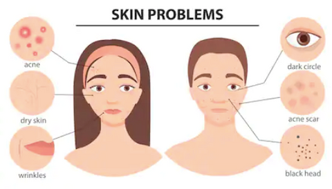 Skin Problems